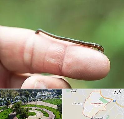 مرکز زالو درمانی در مهرشهر کرج