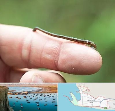 مرکز زالو درمانی در چابهار