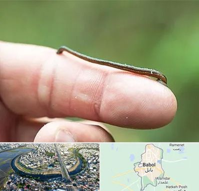 مرکز زالو درمانی در بابل