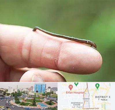 مرکز زالو درمانی در ونک