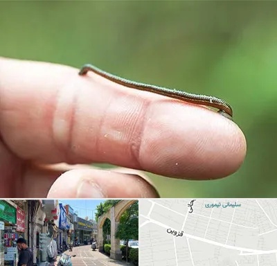 مرکز زالو درمانی در خیابان قزوین
