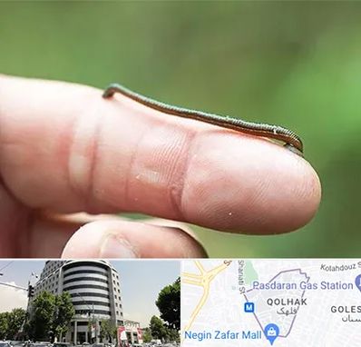 مرکز زالو درمانی در قلهک