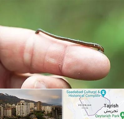 مرکز زالو درمانی در زعفرانیه