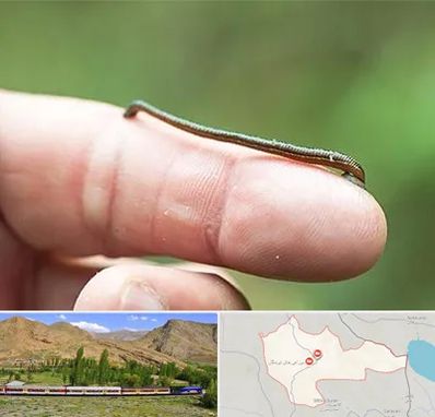 مرکز زالو درمانی در خاش