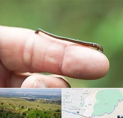 مرکز زالو درمانی در سوهانک