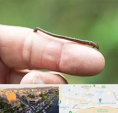 مرکز زالو درمانی در تهرانپارس