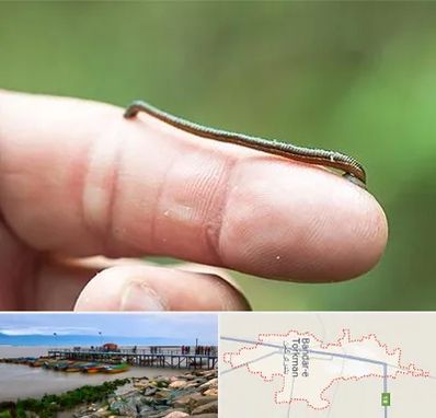 مرکز زالو درمانی در بندر ترکمن