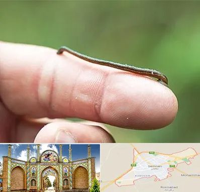 مرکز زالو درمانی در سمنان