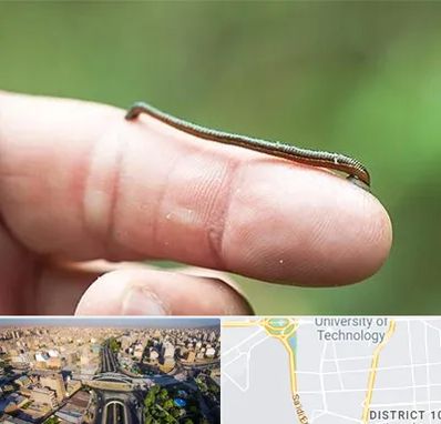 مرکز زالو درمانی در استاد معین