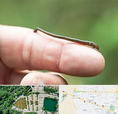 مرکز زالو درمانی در وکیل آباد مشهد