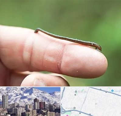 مرکز زالو درمانی در ازگل