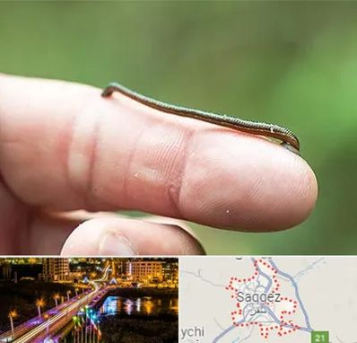 مرکز زالو درمانی در سقز