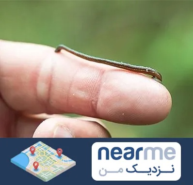 مرکز زالو درمانی در نزدیک من