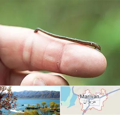 مرکز زالو درمانی در مریوان