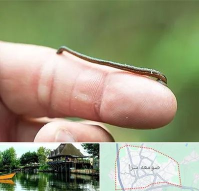 مرکز زالو درمانی در صومعه سرا