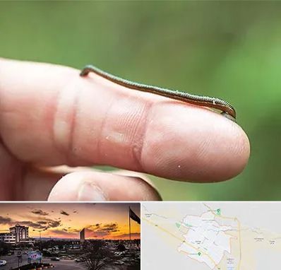 مرکز زالو درمانی در قوچان