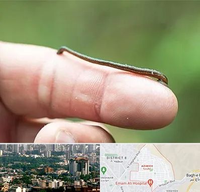 مرکز زالو درمانی در عظیمیه کرج