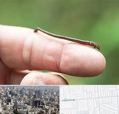 مرکز زالو درمانی در جیحون