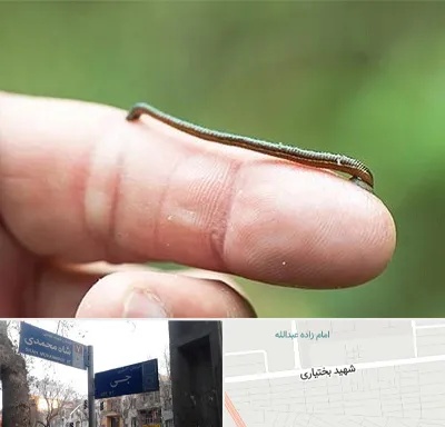 مرکز زالو درمانی در سی متری جی