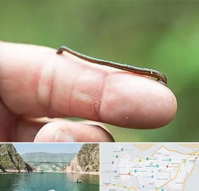 مرکز زالو درمانی در ایلام