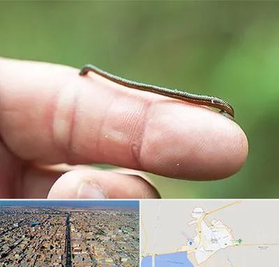 مرکز زالو درمانی در بندر ماهشهر