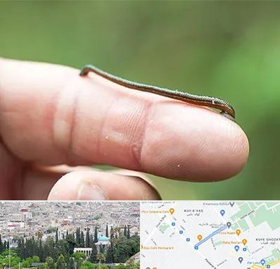 مرکز زالو درمانی در محلاتی شیراز