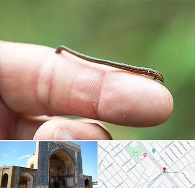 مرکز زالو درمانی در مصلی مشهد