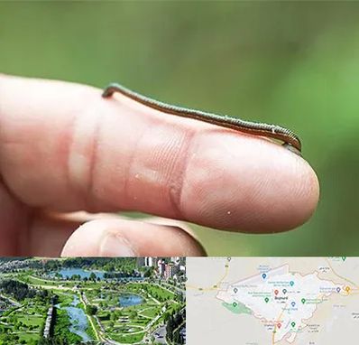 مرکز زالو درمانی در بجنورد