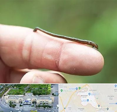 مرکز زالو درمانی در نسیم شهر