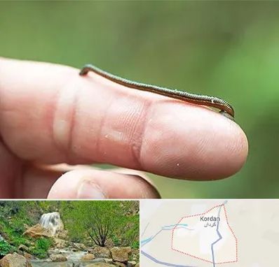 مرکز زالو درمانی در کردان