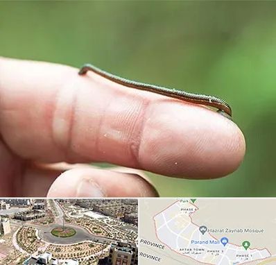 مرکز زالو درمانی در پرند