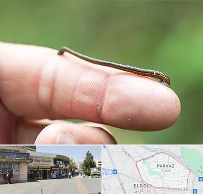 مرکز زالو درمانی در پرواز تبریز