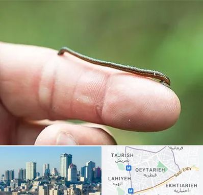 مرکز زالو درمانی در قیطریه