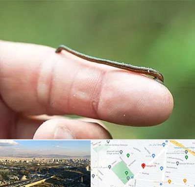 مرکز زالو درمانی در هنگام