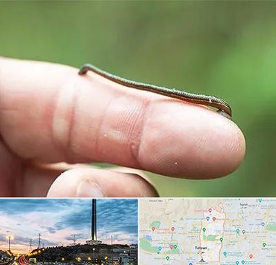 مرکز زالو درمانی در منطقه 2 تهران