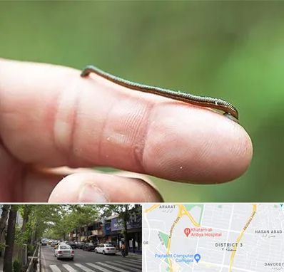 مرکز زالو درمانی در ظفر