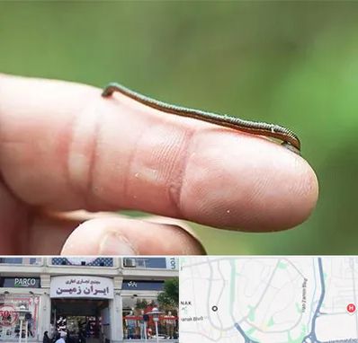 مرکز زالو درمانی در ایران زمین