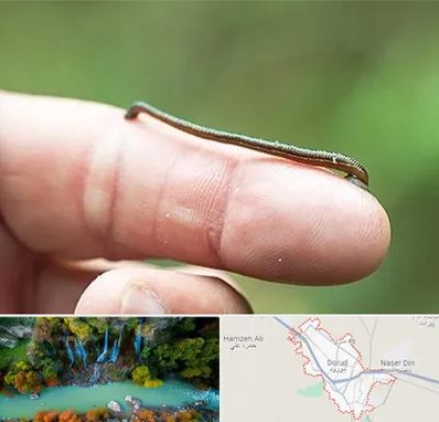 مرکز زالو درمانی در دورود