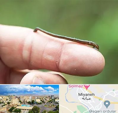 مرکز زالو درمانی در میانه