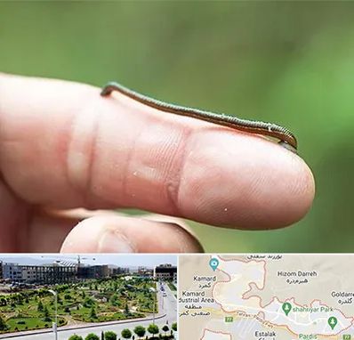 مرکز زالو درمانی در پردیس