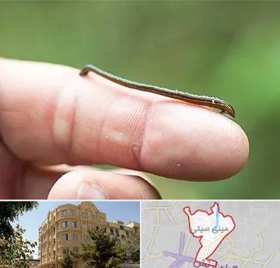 مرکز زالو درمانی در مینی سیتی