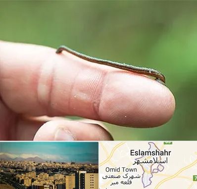 مرکز زالو درمانی در اسلامشهر