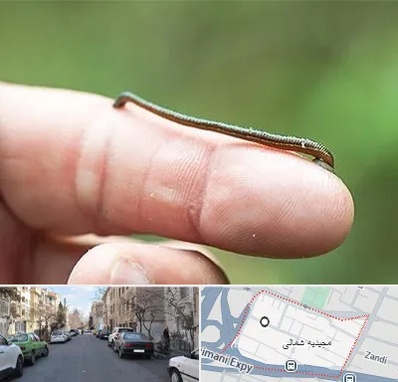 مرکز زالو درمانی در مجیدیه شمالی