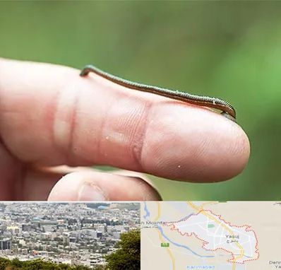 مرکز زالو درمانی در یاسوج