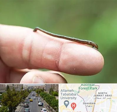 مرکز زالو درمانی در شهران