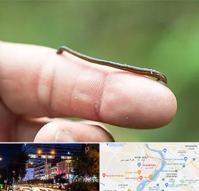 مرکز زالو درمانی در کیانپارس اهواز