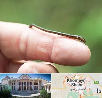 مرکز زالو درمانی در خمینی شهر