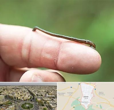 مرکز زالو درمانی در قزوین