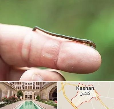 مرکز زالو درمانی در کاشان