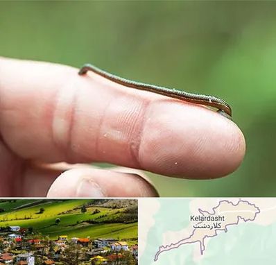 مرکز زالو درمانی در کلاردشت